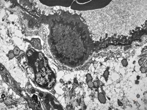 jejunum … lipid malabsorption